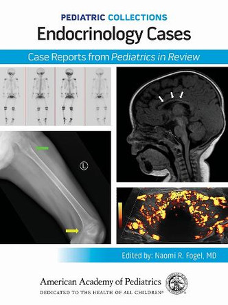 Endocrinology Cases: Case Reports from Pediatrics in Review American Academy of Pediatrics (AAP) 9781610028301