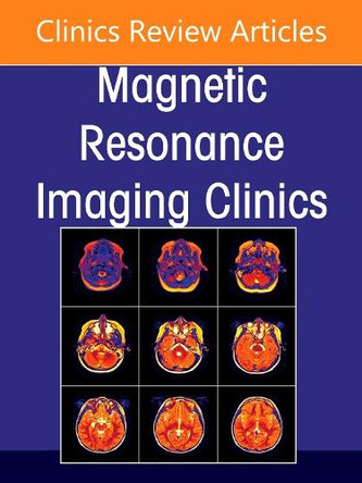 Plexus and Peripheral Nerve MR Imaging: Advances and Applications, An Issue of Magnetic Resonance Imaging Clinics of North America: Volume 33-3 Laura M. Fayad 9780443313721