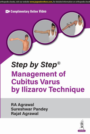 Step by Step: Management of Cubitus Varus by Ilizarov Technique by RA Agrawal 9789366162263