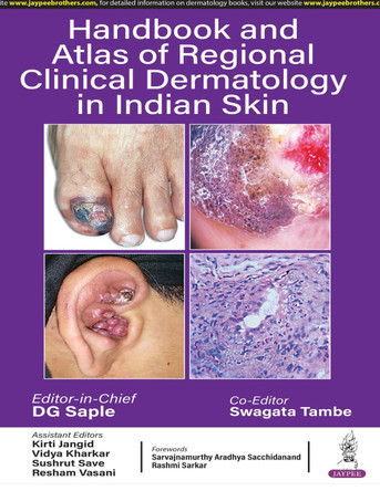 Handbook and Atlas of Regional Clinical Dermatology in Indian Skin by DG Saple 9789356961746