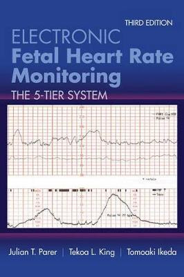 Electronic Fetal Heart Rate Monitoring by Julian T. Parer