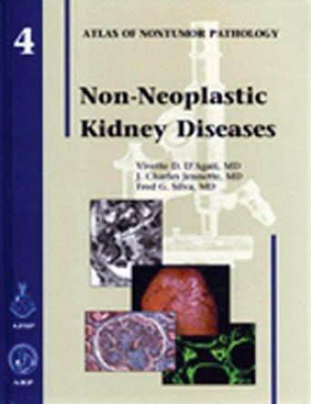 Non-Neoplastic Kidney Diseases by Vivette D. D'Agati 9781881041962