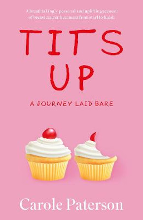 Tits Up by Carole Paterson