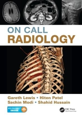 On Call Radiology by Gareth Lewis 9781482221671