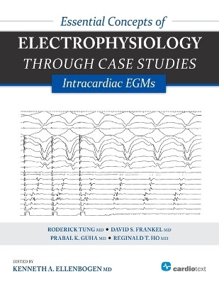 Essential Concepts of Electrophysiology Through Case Studies: Intracardiac EGMs by Kenneth A. Ellenbogen 9781935395331