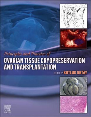 Principles and Practice of Ovarian Tissue Cryopreservation and Transplantation by Kutluk Oktay