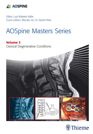 AOSpine Masters Series Volume 3: Cervical Degenerative Conditions by K. Daniel Riew 9781626230507