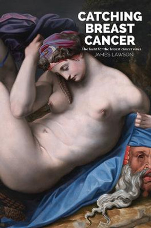 Catching Breast Cancer: The hunt for the breast cancer virus by James Lawson