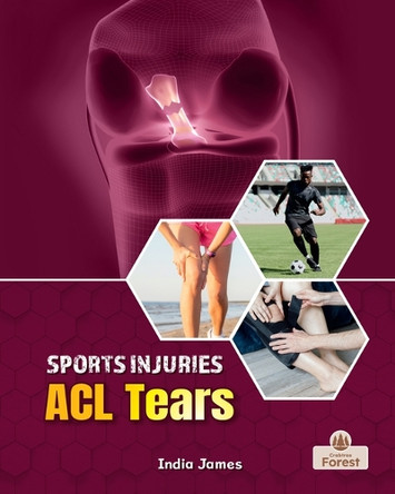 ACL Tears by India James 9781039880795