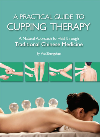Practical Guide to Cupping Therapy: A Natural Approach to Heal Through Traditional Chinese Medicine by Zhongchao Wu 9781632880758