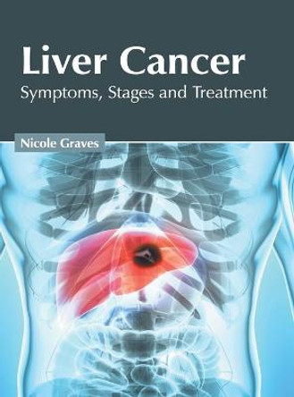 Liver Cancer: Symptoms, Stages and Treatment by Nicole Graves
