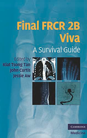 Final FRCR 2B Viva: A Survival Guide by Kiat Tsong Tan 9780521183079