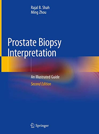 Prostate Biopsy Interpretation: An Illustrated Guide by Rajal B. Shah 9783030136000