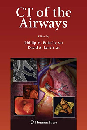 CT of the Airways by Phillip M. Boiselle 9781607615507