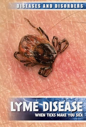 Lyme Disease: When Ticks Make You Sick by Raymond J Lampke 9781534563629