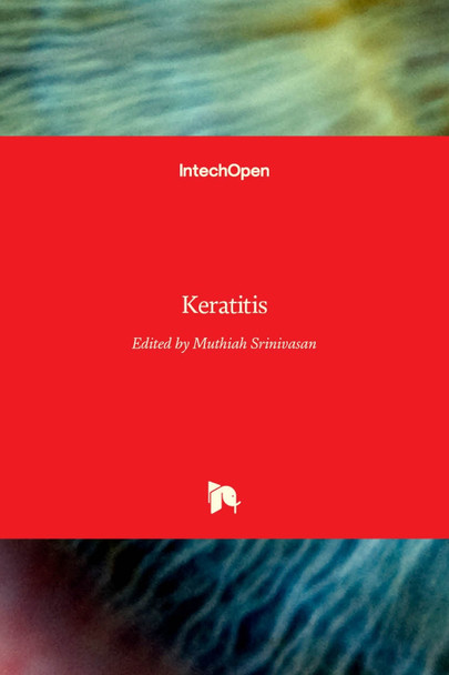 Keratitis by Muthiah Srinivasan 9789535105688
