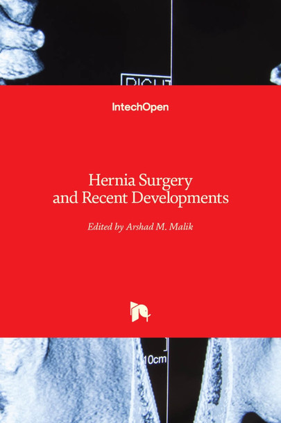 Hernia Surgery and Recent Developments by Arshad M. Malik 9781789234466