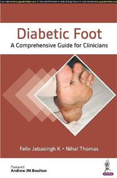 Diabetic Foot: A Comprehensive Guide for Clinicians by Felix Jebasingh K