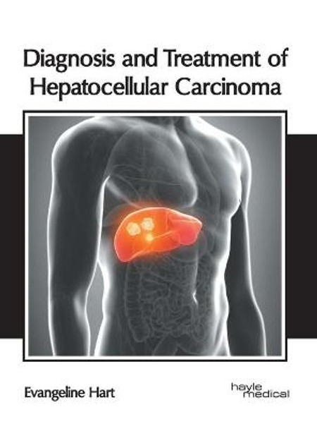 Diagnosis and Treatment of Hepatocellular Carcinoma by Evangeline Hart