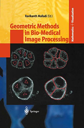 Geometric Methods in Bio-Medical Image Processing by Ravikanth Malladi 9783540432166