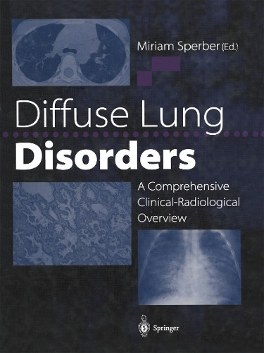 Diffuse Lung Disorders: A Comprehensive Clinical-Radiological Overview by Miriam Sperber 9781447134428