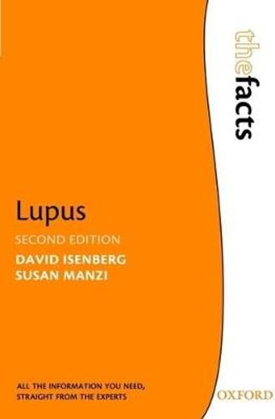 Lupus by David Isenberg