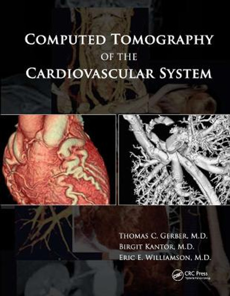 Computed Tomography of the Cardiovascular System by Thomas C Gerber
