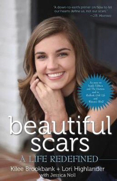 Beautiful Scars: A Life Redefined by Kilee Brookbank