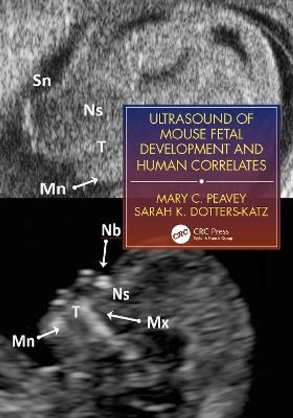 Ultrasound of Murine Fetal Development with Human Correlation by Mary C. Peavey