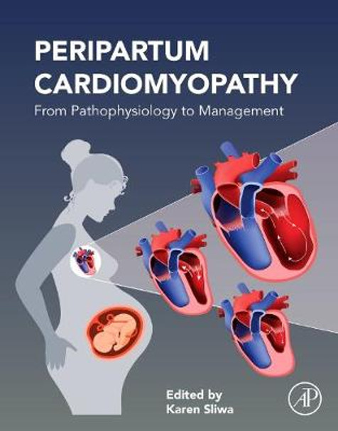 Peripartum Cardiomyopathy: From Pathophysiology to Management by Karen Sliwa