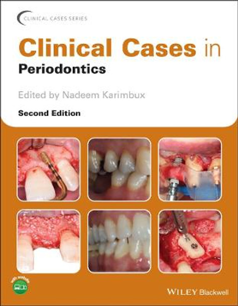 Clinical Cases in Periodontics by Nadeem Karimbux