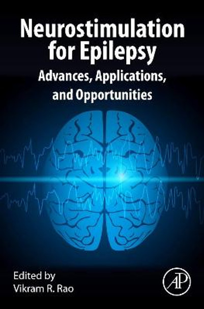 Neurostimulation for Epilepsy: Advances, Applications and Opportunities by Vikram R. Rao