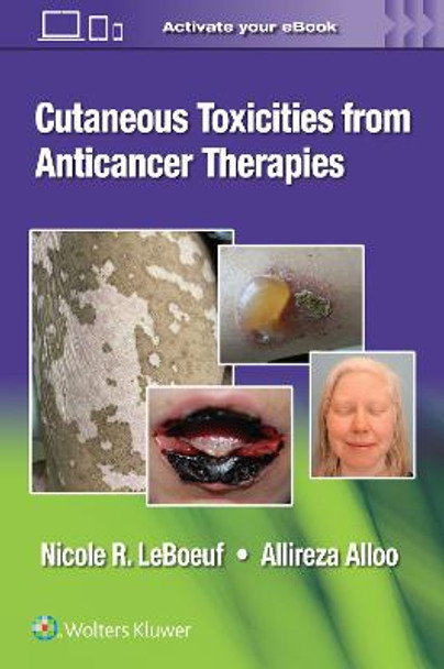 Cutaneous Reactions from Anti-Cancer Therapies by Dr. Allireza Alloo