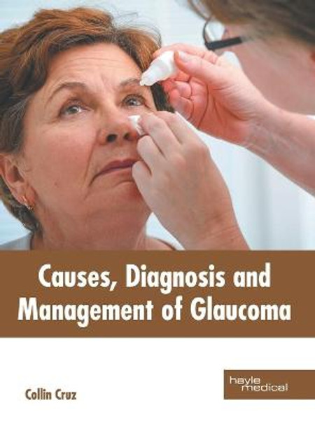 Causes, Diagnosis and Management of Glaucoma by Collin Cruz