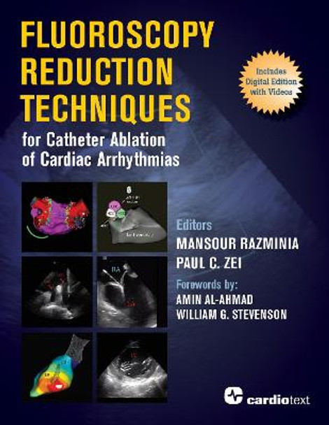 Fluoroscopy Reduction Techniques for Catheter Ablation of Cardiac Arrhythmias by Mansour Razminia