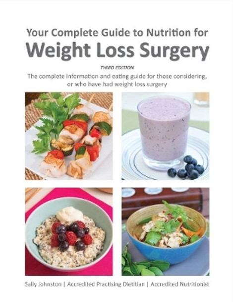 Your Complete Guide to Nutrition for Weight Loss Surgery by Sally Johnston