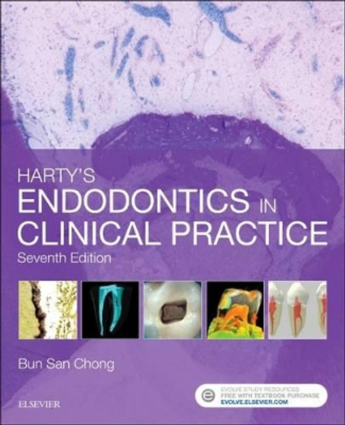 Harty's Endodontics in Clinical Practice by Bun San Chong