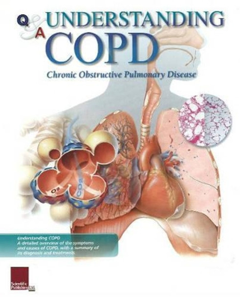 Understanding COPD Flip Chart by Scientific Publishing 9781932922295