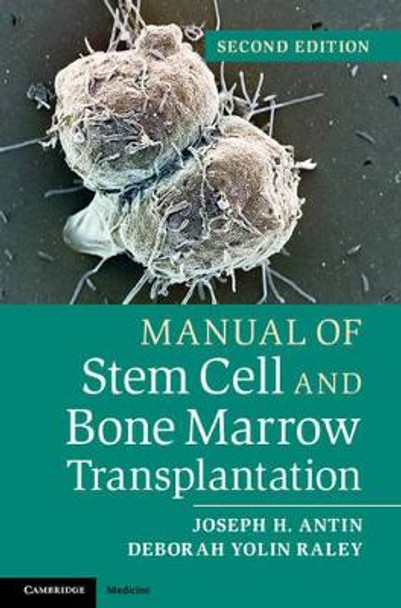 Manual of Stem Cell and Bone Marrow Transplantation by Joseph H. Antin 9781107661547