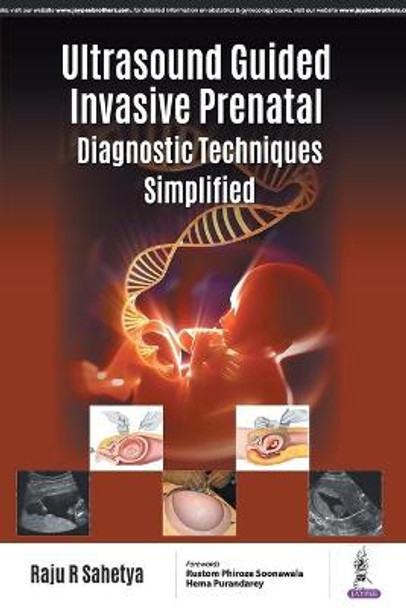 Ultrasound Guided Invasive Prenatal Diagnostic Techniques Simplified by Raju R Sahetya