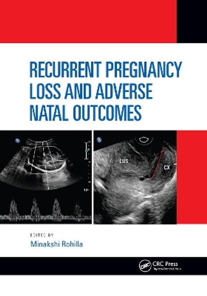 Recurrent Pregnancy Loss and Adverse Natal Outcomes by Minakshi Rohilla 9781032173481