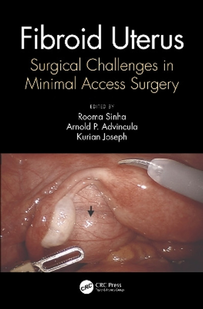 FIBROID UTERUS Surgical Challenges in Minimal Access Surgery: Surgical Challenges in Minimal Access Surgery by Rooma Sinha 9780367620554