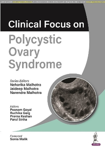 Clinical Focus on Polycystic Ovary Syndrome by Neharika Malhotra 9789356960916