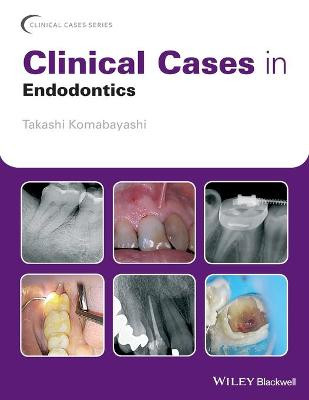 Clinical Cases in Endodontics Takashi Komabayashi 9781119147046