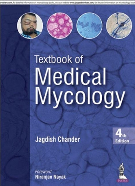 Textbook of Medical Mycology by Jagdish Chander 9789386261830