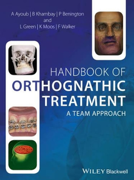 Handbook of Orthognathic Treatment: A Team Approach by Ashraf Ayoub 9780470659052