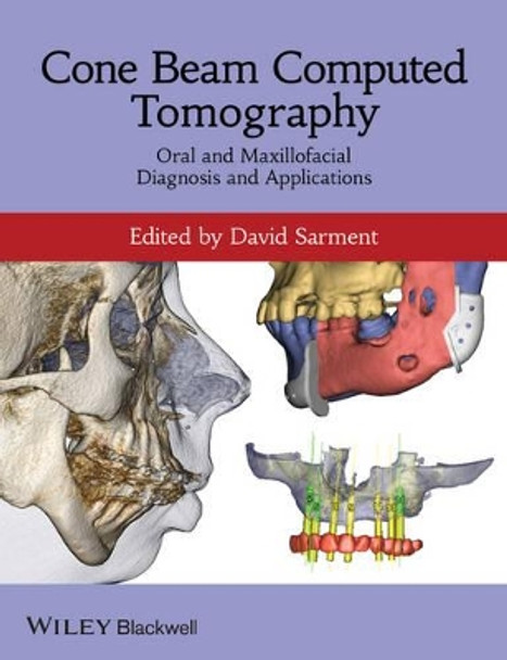 Cone Beam Computed Tomography: Oral and Maxillofacial Diagnosis and Applications by David P. Sarment 9780470961407