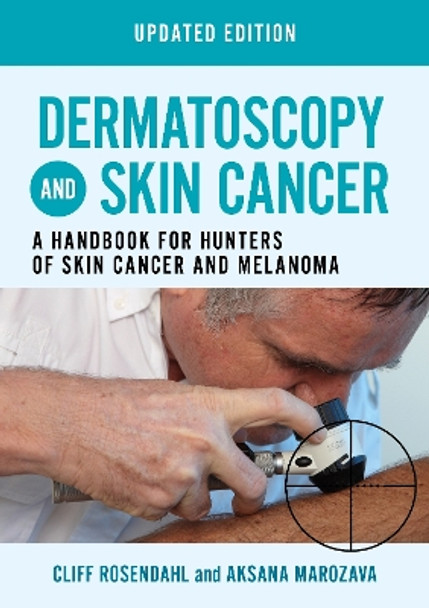 Dermatoscopy and Skin Cancer, updated edition: A handbook for hunters of skin cancer and melanoma by Cliff Rosendahl 9781914961205