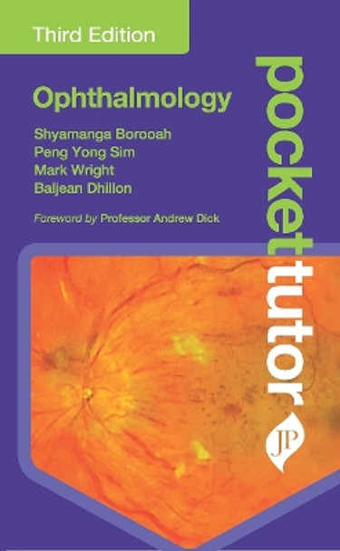 Pocket Tutor Ophthalmology by Shyamanga Borooah 9781787791640