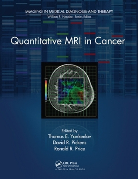 Quantitative MRI in Cancer by Thomas E. Yankeelov 9780367576875